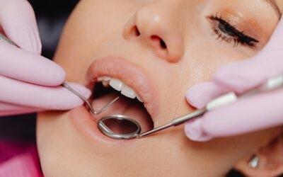 Untangling Dental Problems: Hidden Solutions